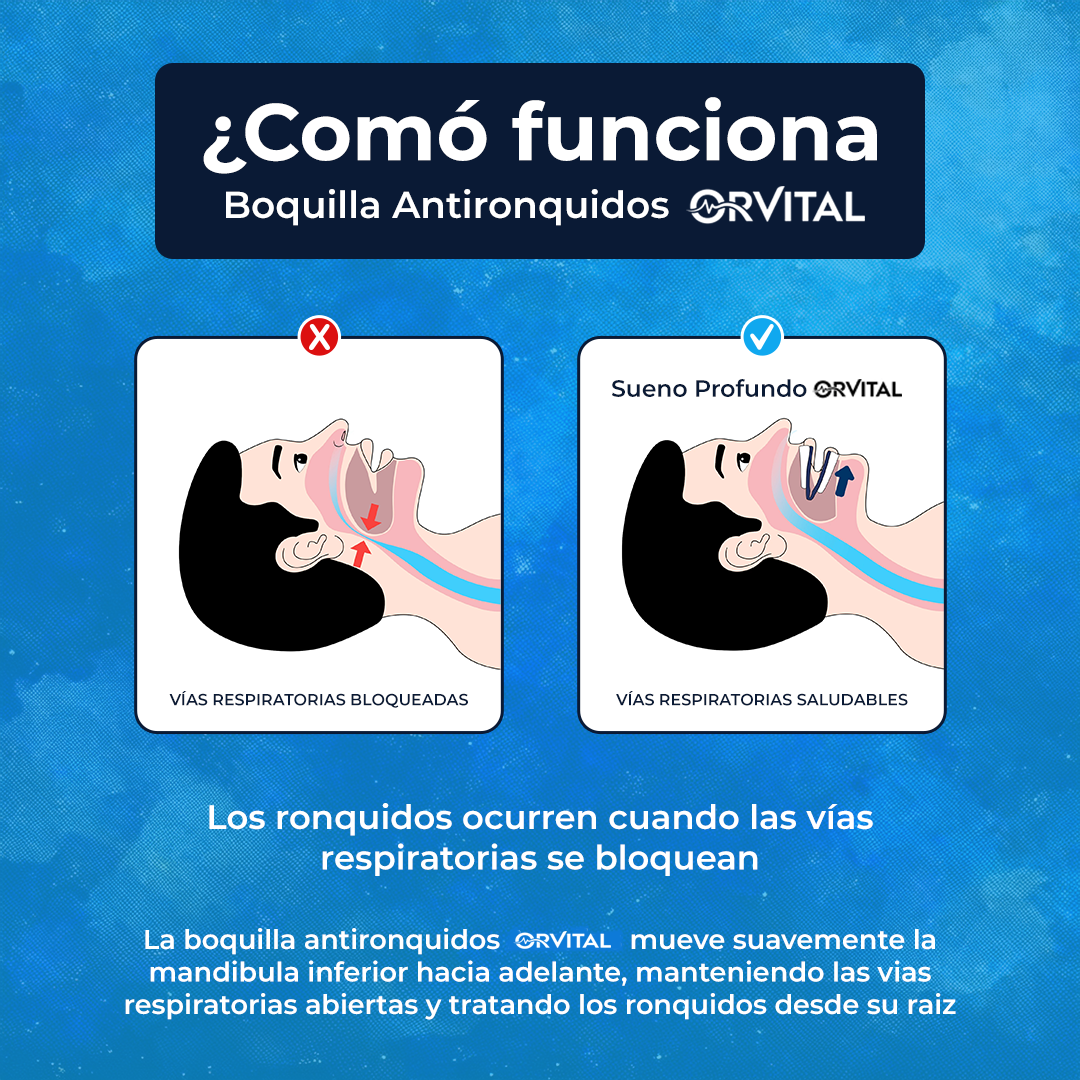 Boquilla Antironquidos Orvital™
