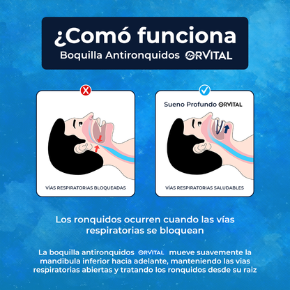Boquilla Antironquidos Orvital™